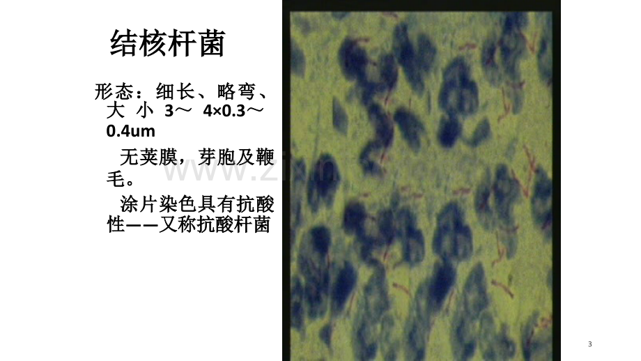 预防结核病.ppt_第3页