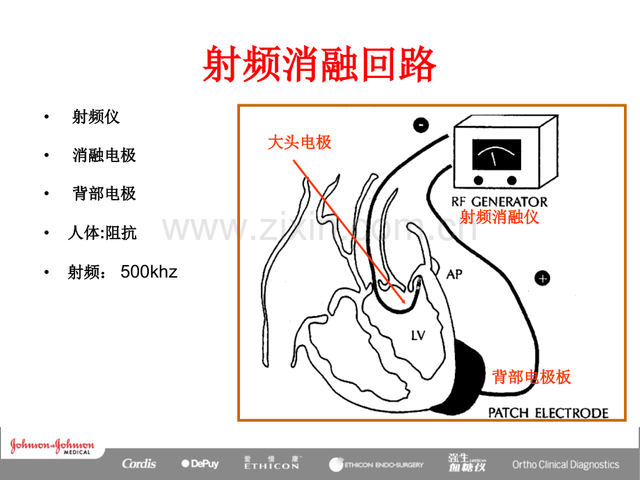 射频消融原理(医学PPT课件).ppt_第3页