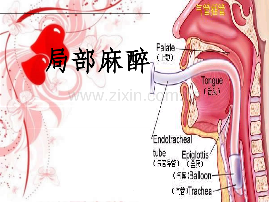 局部麻醉护理.ppt_第1页