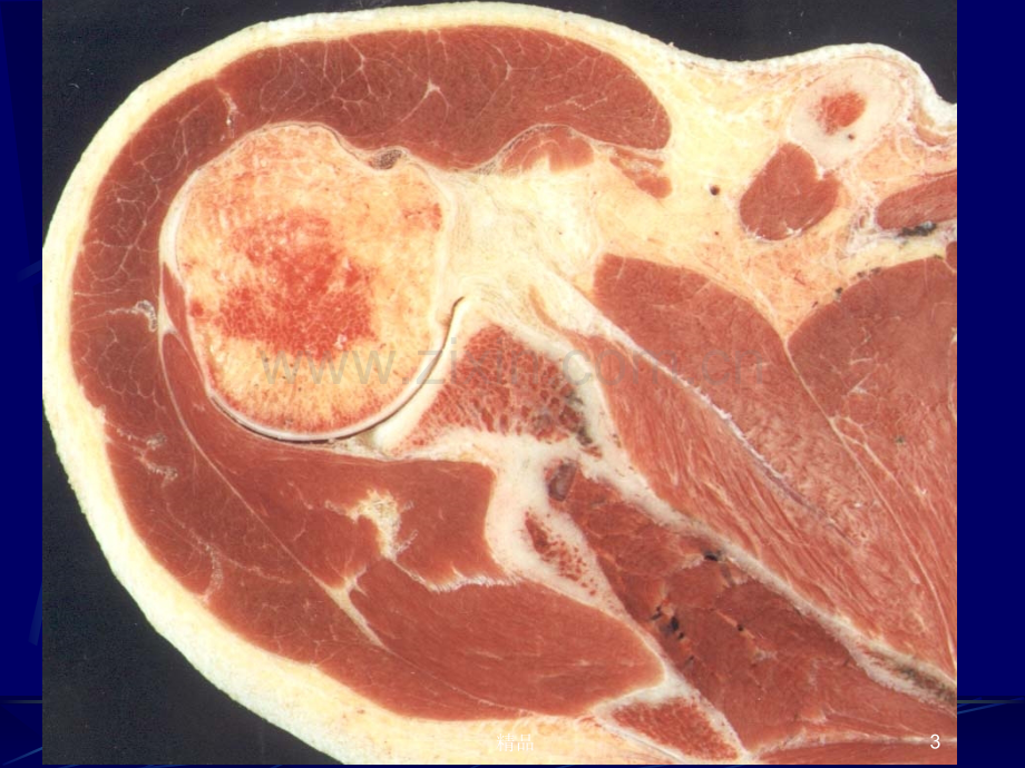 四肢断层解剖及CT、MRI.ppt_第3页