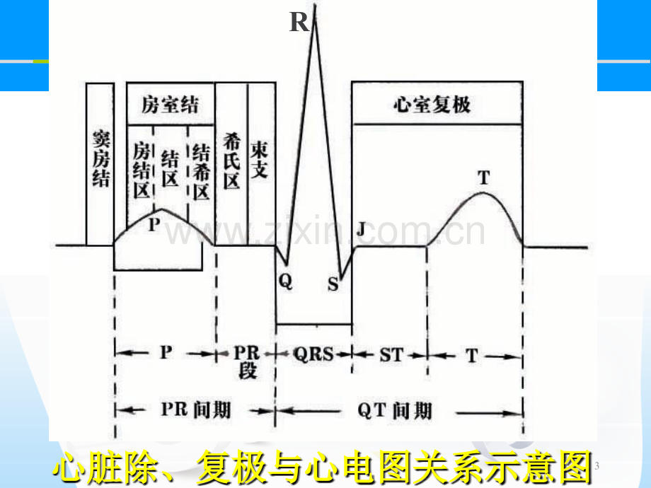 心电图基础图解.ppt_第3页