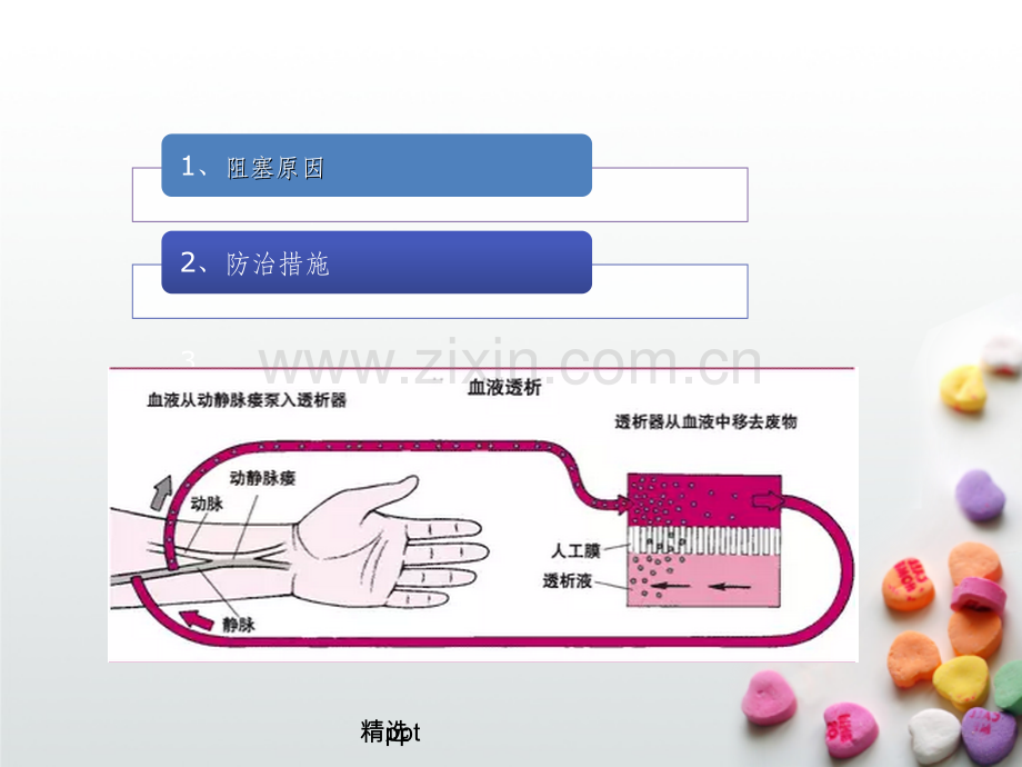 血液透析患者动静脉内瘘阻塞原因及预防措施.ppt_第2页