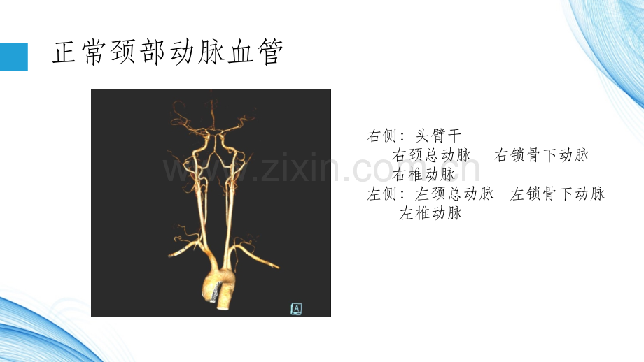 头颈部血管变异.ppt_第2页