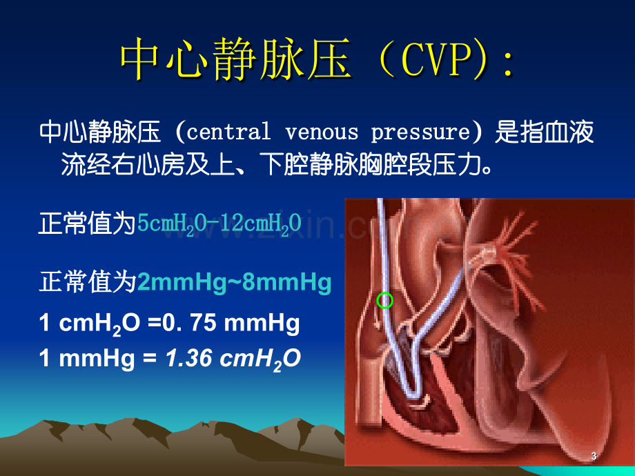 中心静脉压CV监测及波形分析.ppt_第3页