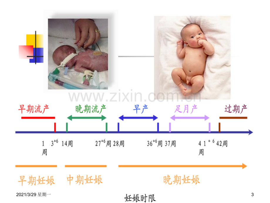 正常分娩(9版妇产科学课件).ppt_第3页