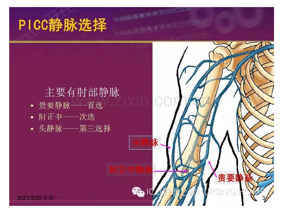 PICC导管的护理.ppt_第3页