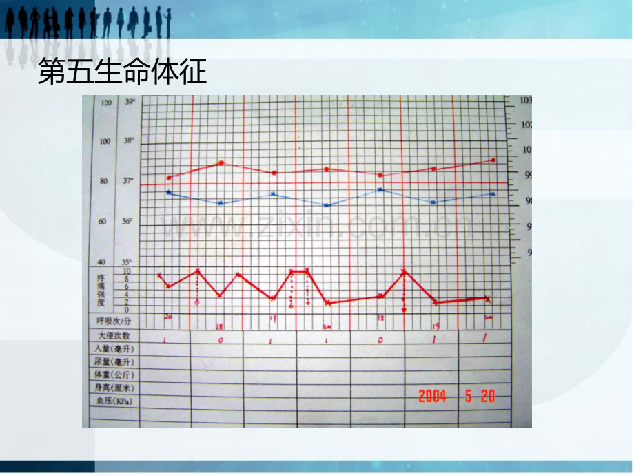 疼痛的评估及护理.ppt_第3页