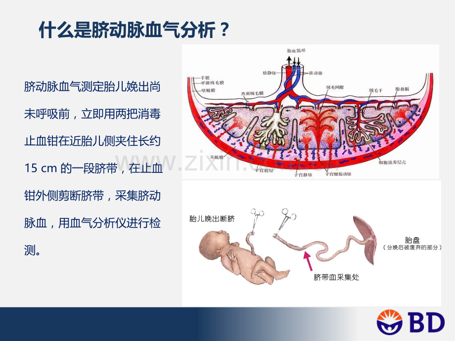 脐动脉血血气分析的临床应用.ppt_第2页