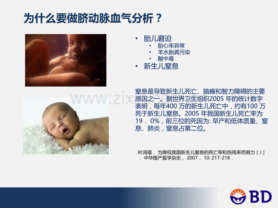 脐动脉血血气分析的临床应用.ppt_第3页