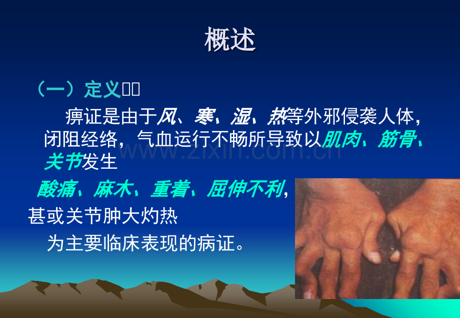 痹证的针灸治疗.ppt_第2页