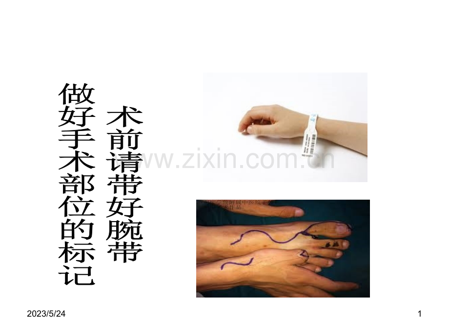 手术室健康宣教.ppt_第1页