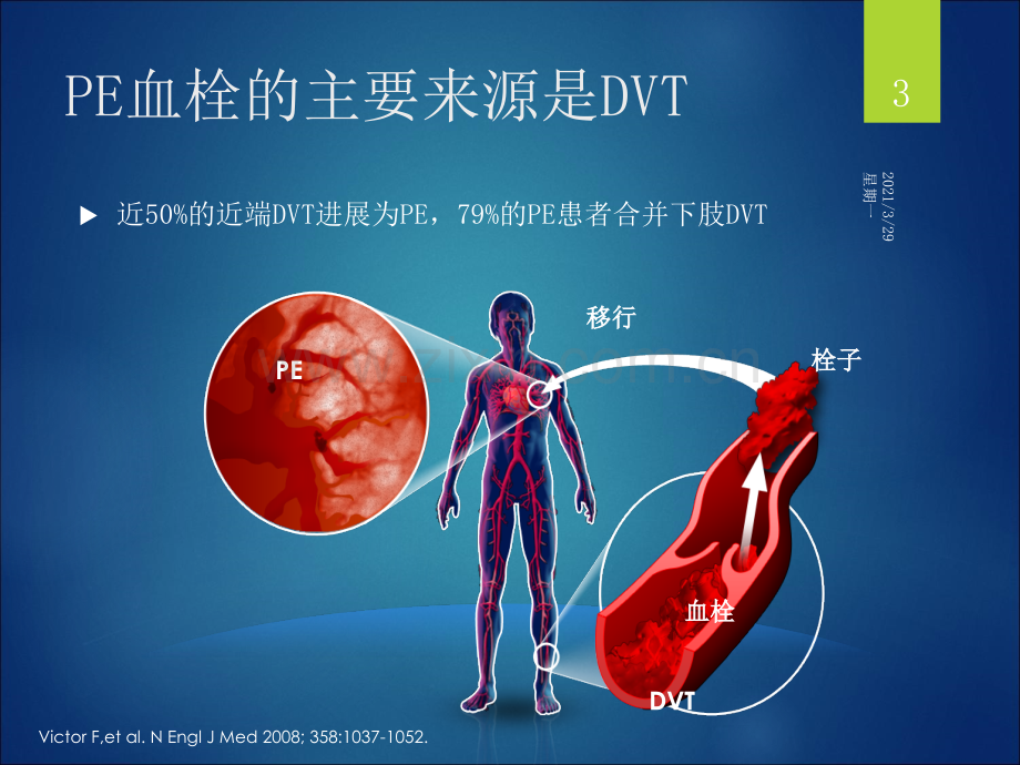 VTE的预防与治疗.ppt_第3页