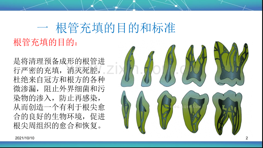 根管治疗术(五)：根管充填.ppt_第2页