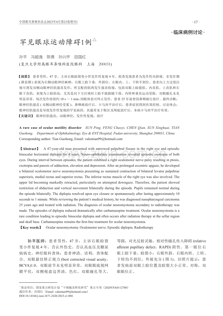 罕见眼球运动障碍1例.pdf_第1页