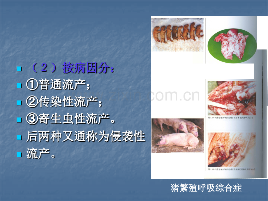 妊娠期疾病.ppt_第3页