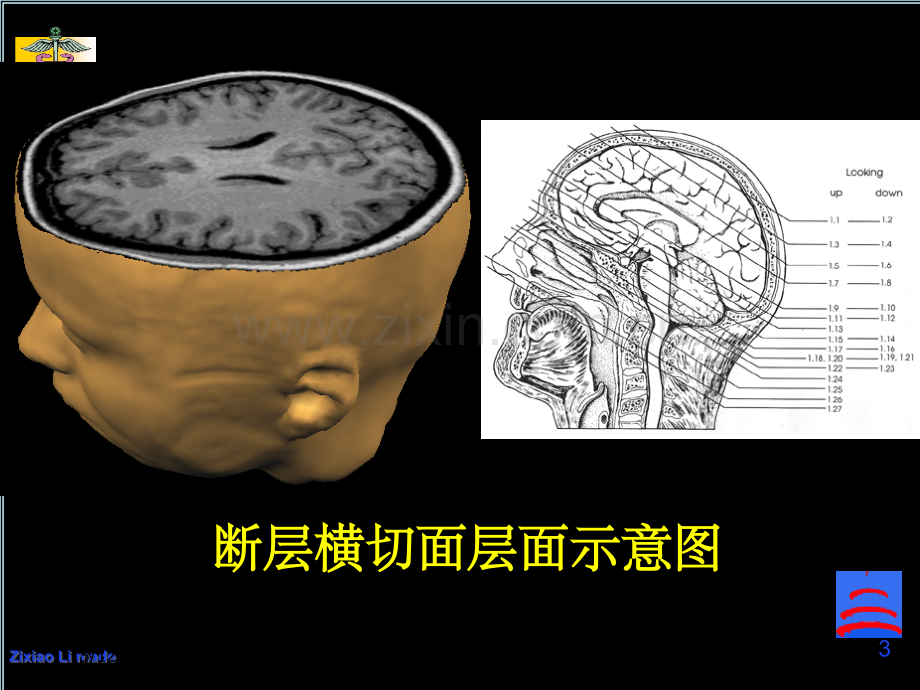 头颅磁共振图谱PPT课件.ppt_第3页