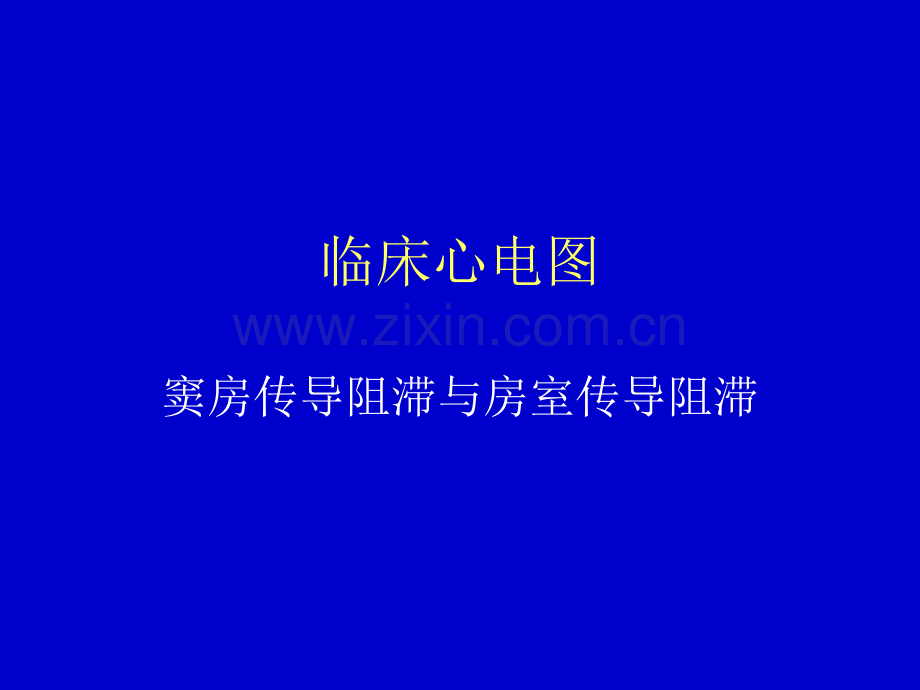 窦房传导阻滞与房室传导阻滞.ppt_第1页