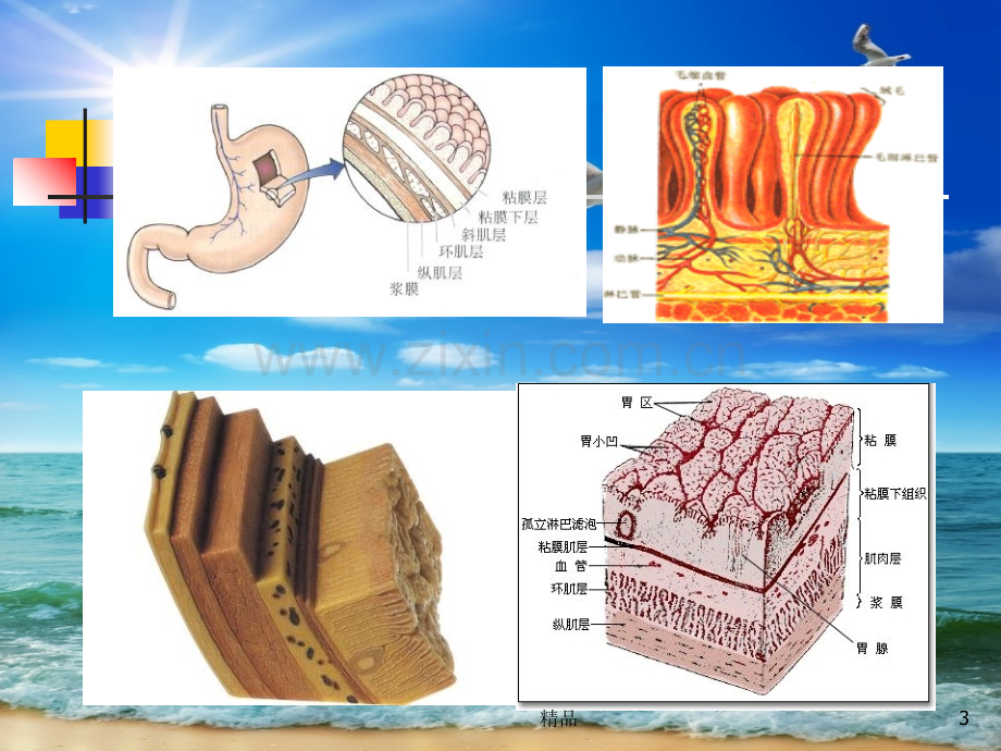 消化内镜治疗新技术.ppt_第3页