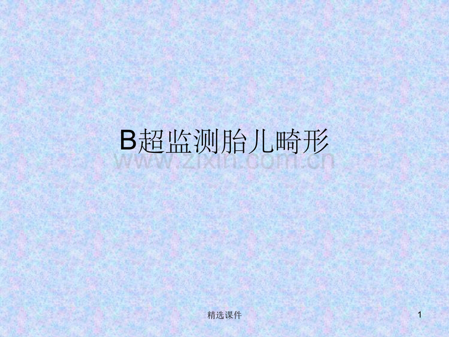 B超胎儿畸形.ppt_第1页