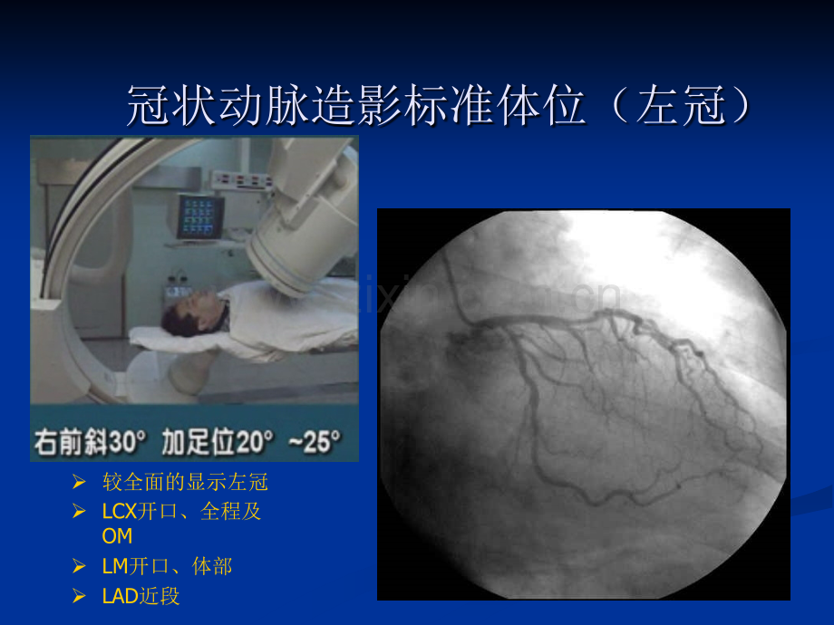 冠脉造影投照体位1.ppt_第2页