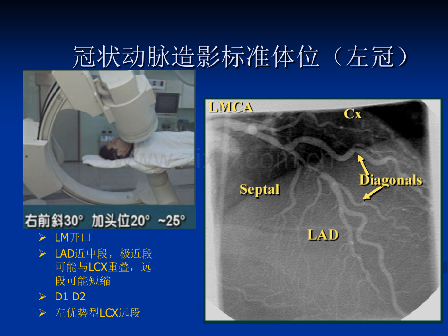 冠脉造影投照体位1.ppt_第3页