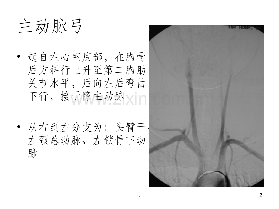 脑血管的正常变异及异常.ppt_第2页