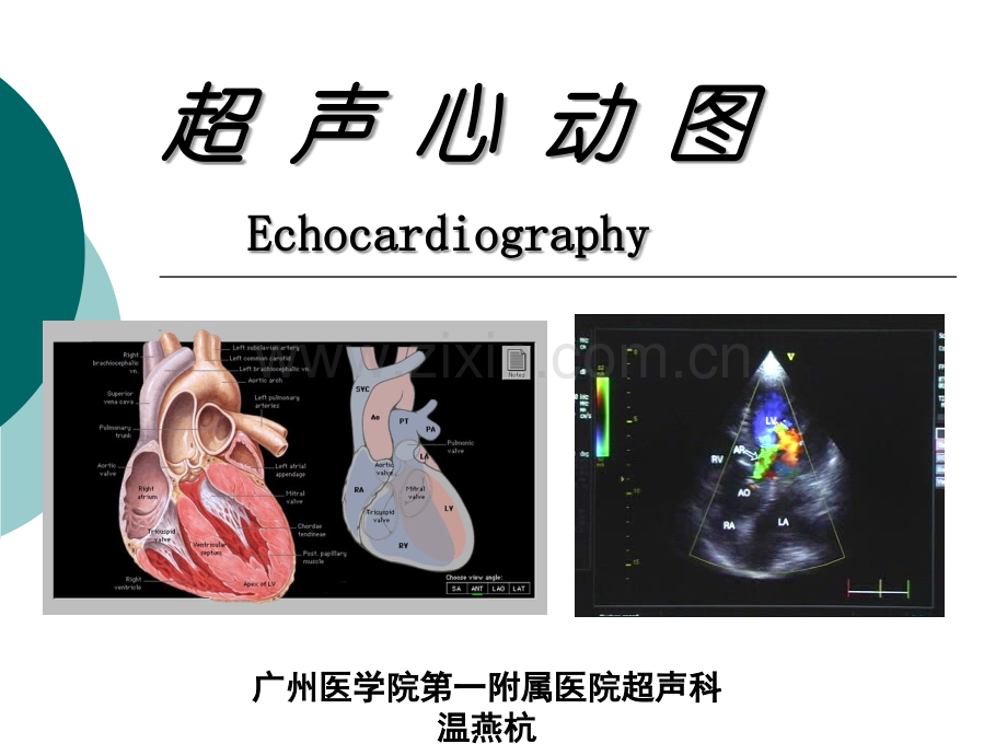 超-声-心-动-图.ppt_第1页