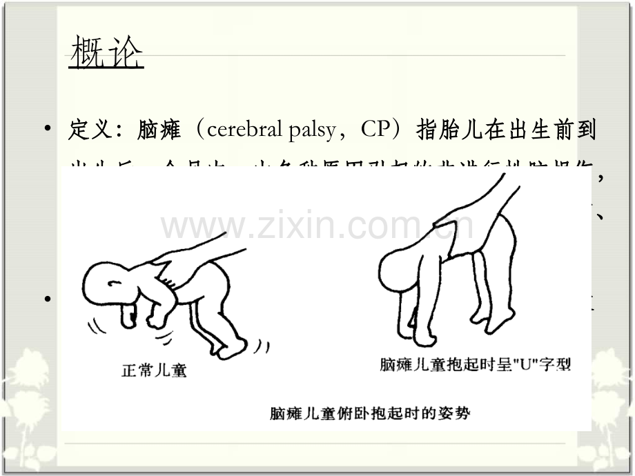 小儿脑瘫的康复.ppt_第2页