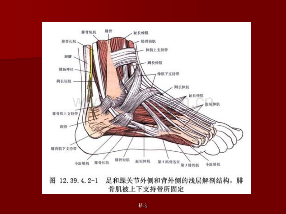 腓骨长短肌腱滑脱.ppt_第3页