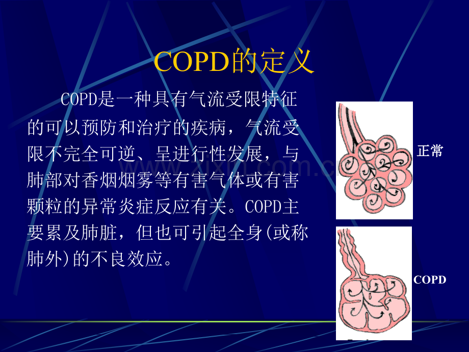 慢性阻塞性肺疾病急性加重期的护理.ppt_第3页