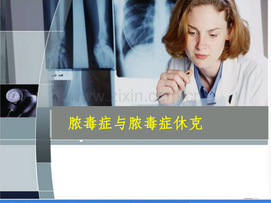 脓毒症脓毒性休克.ppt_第1页