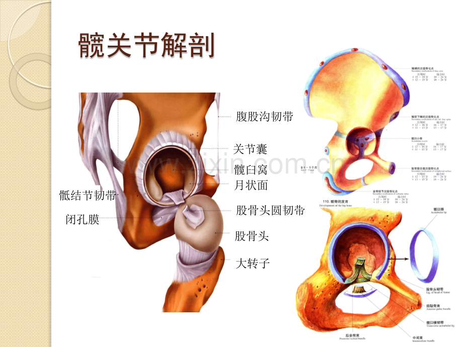 髋关节MRIPPT医学.pptx_第3页