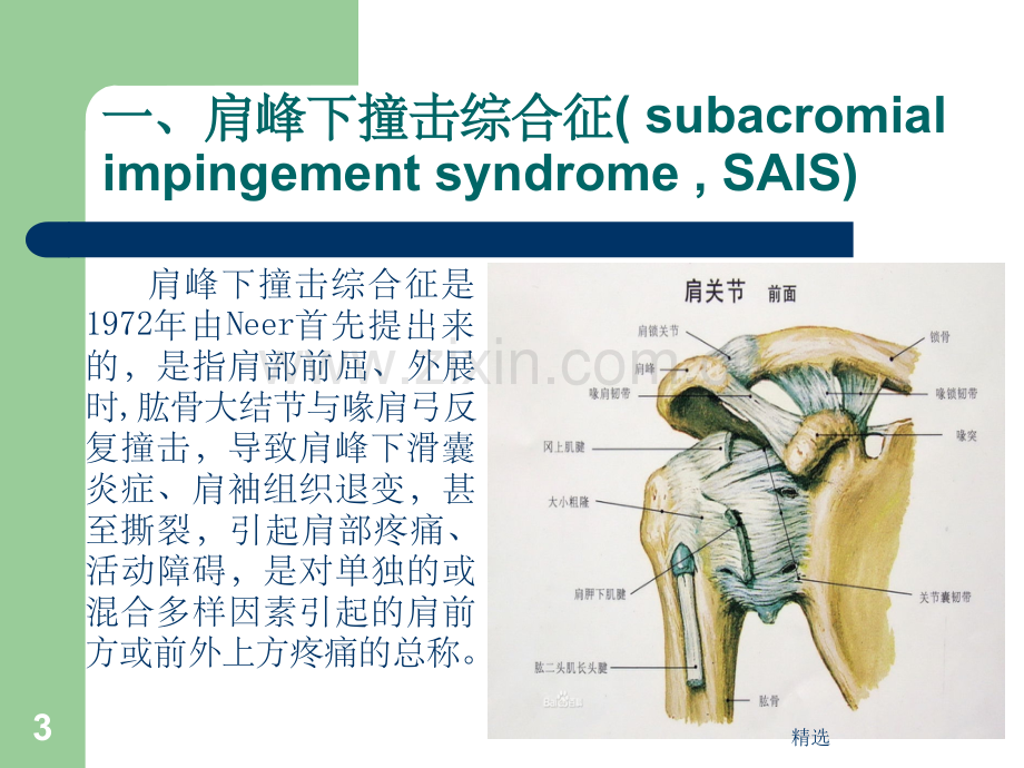 肩峰下撞击综合征.ppt_第3页