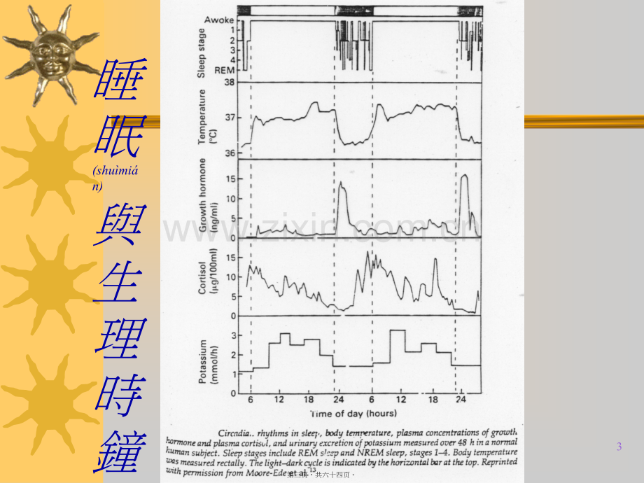 常见睡眠障碍.ppt_第3页