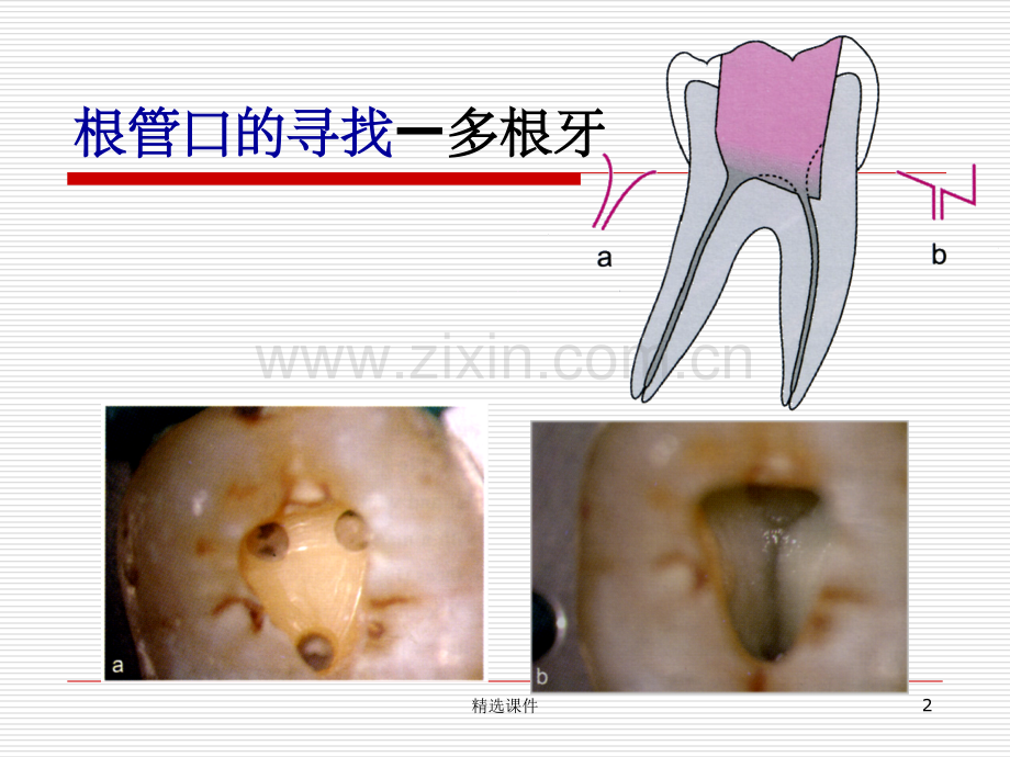 根管预备详解.ppt_第2页