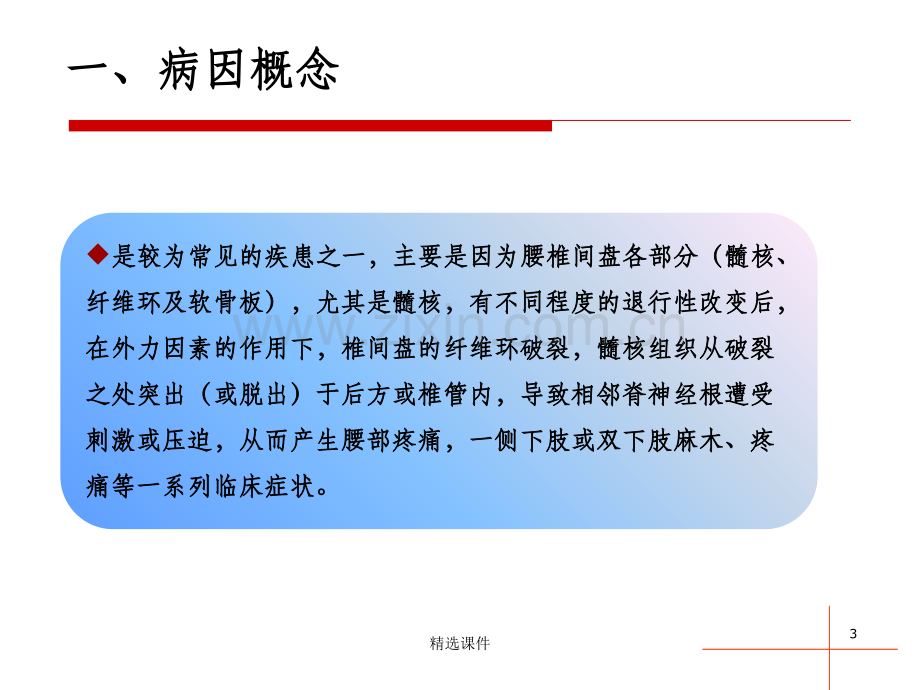 腰椎间盘突出诊断与鉴别诊断.ppt_第3页