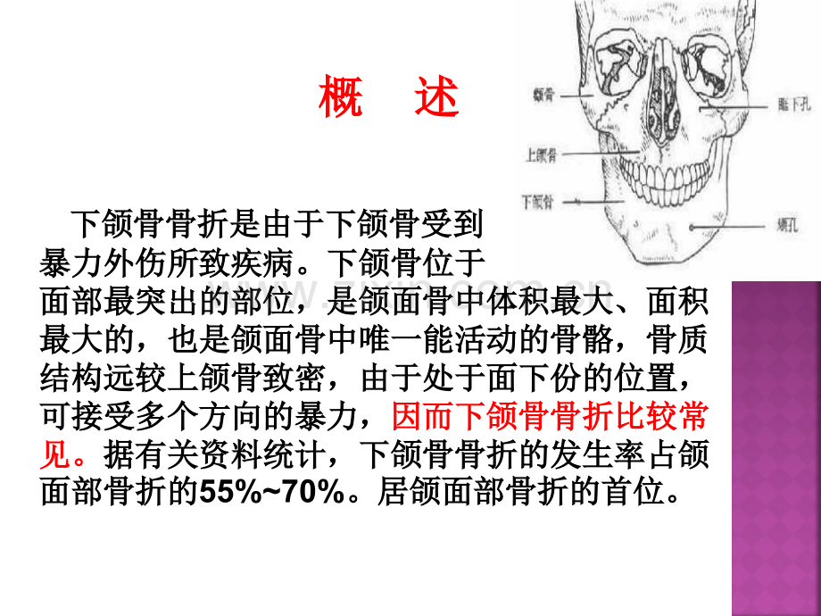 下颌骨骨折的护理查房.ppt_第2页