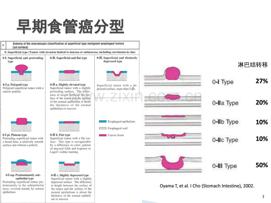 NBI+放大在食管早癌诊断中的应用进展.ppt_第3页