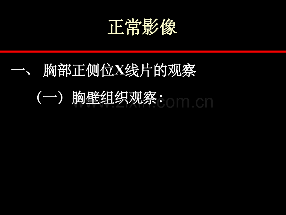 胸片阅读(必看).ppt_第2页