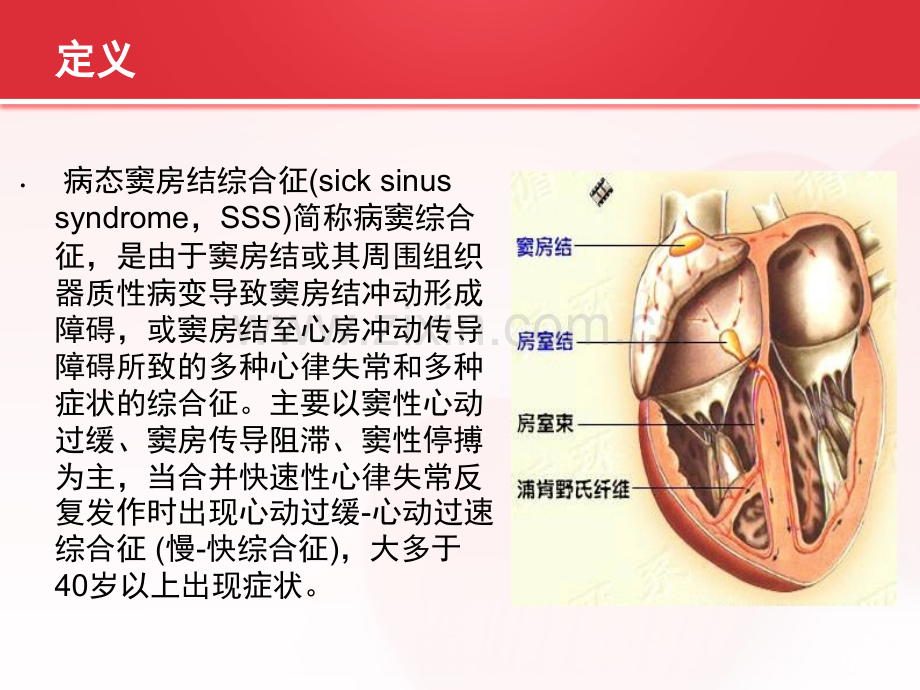 病态窦房结综合症的护理查房.ppt_第2页