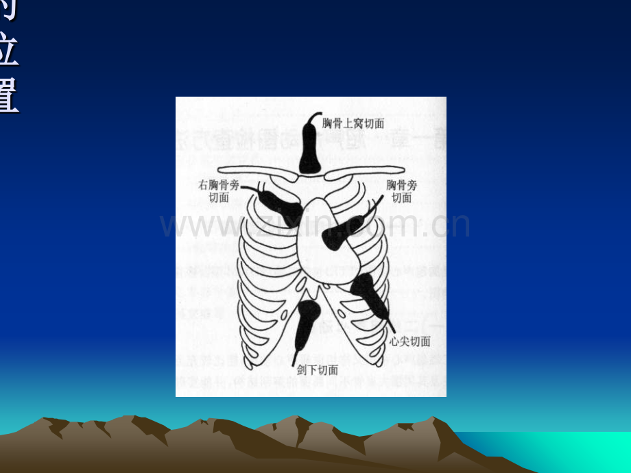 正常的超声心动图.ppt_第3页