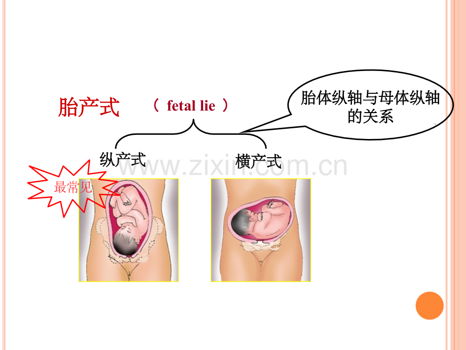 产科四部触诊.ppt_第3页