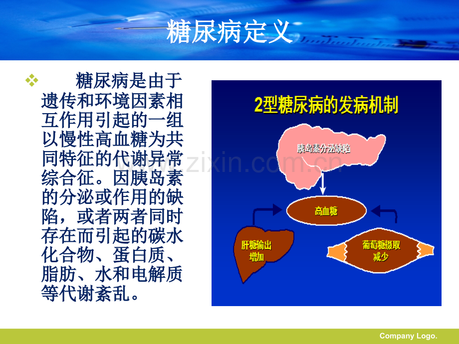 2型糖尿病护理查房.ppt_第2页