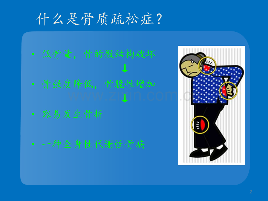 骨质疏松的预防及用药注意事项.ppt_第2页