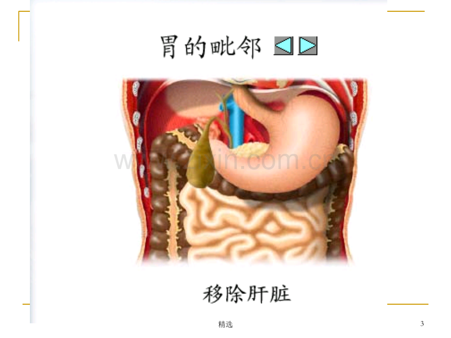 胃十二指肠疾病病人的护理.ppt_第3页