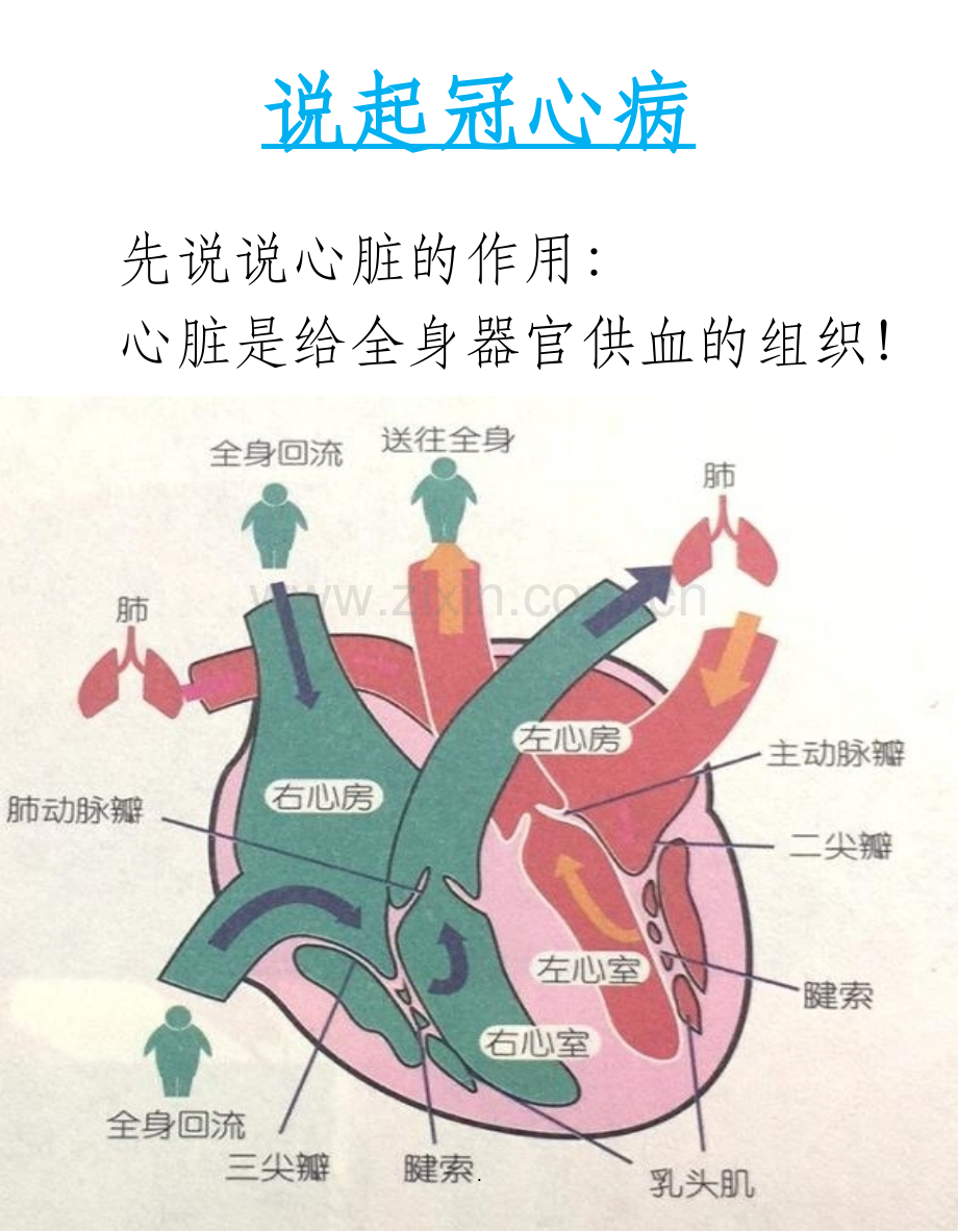 图解冠心病和心肌梗塞的前世今生.ppt_第3页