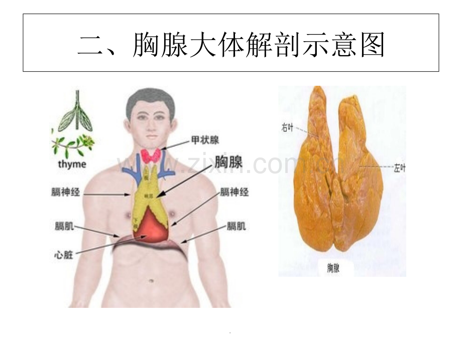 胸腺瘤影像表现.ppt_第3页