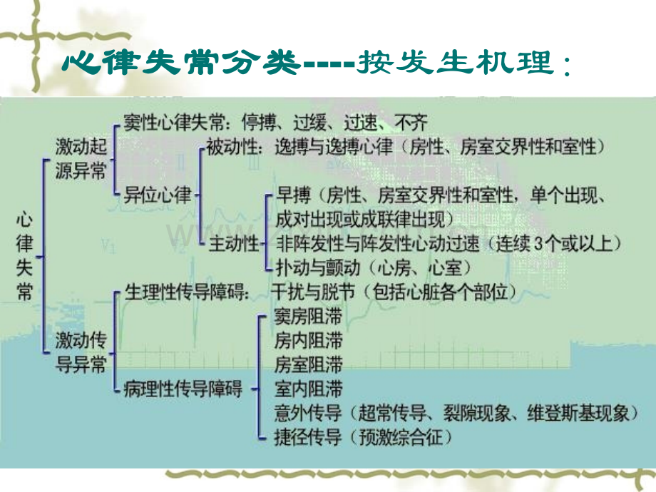 危急重症心律失常心电图.ppt_第3页