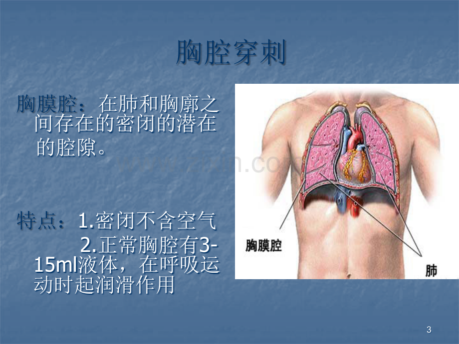 胸穿腹穿骨穿腰穿四大穿刺.ppt_第3页