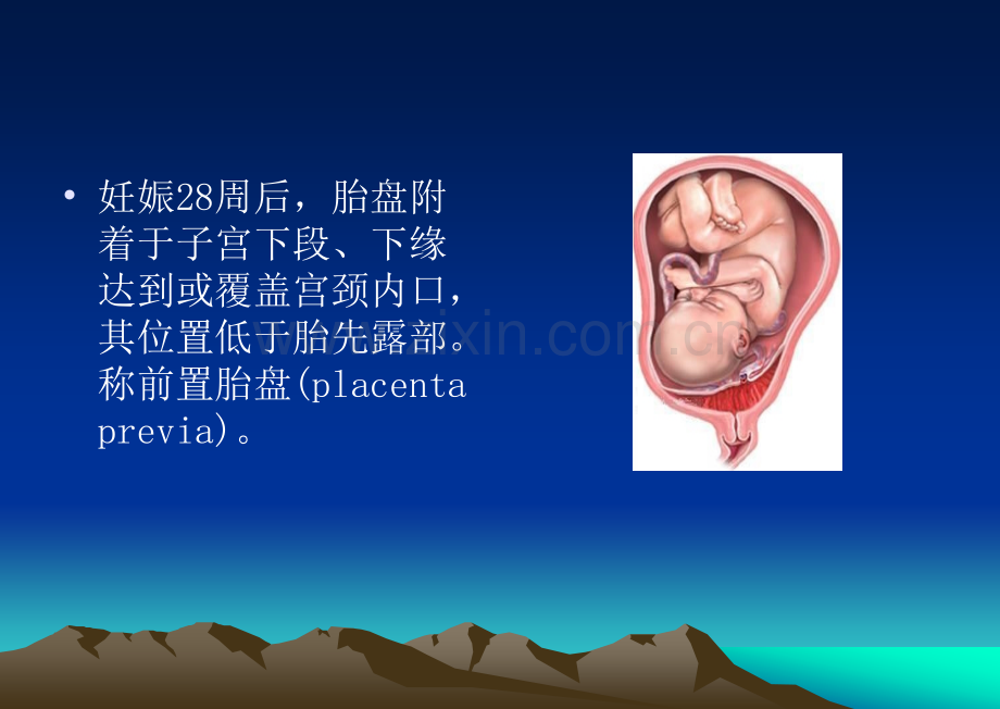 前置胎盘教学查房.ppt_第2页